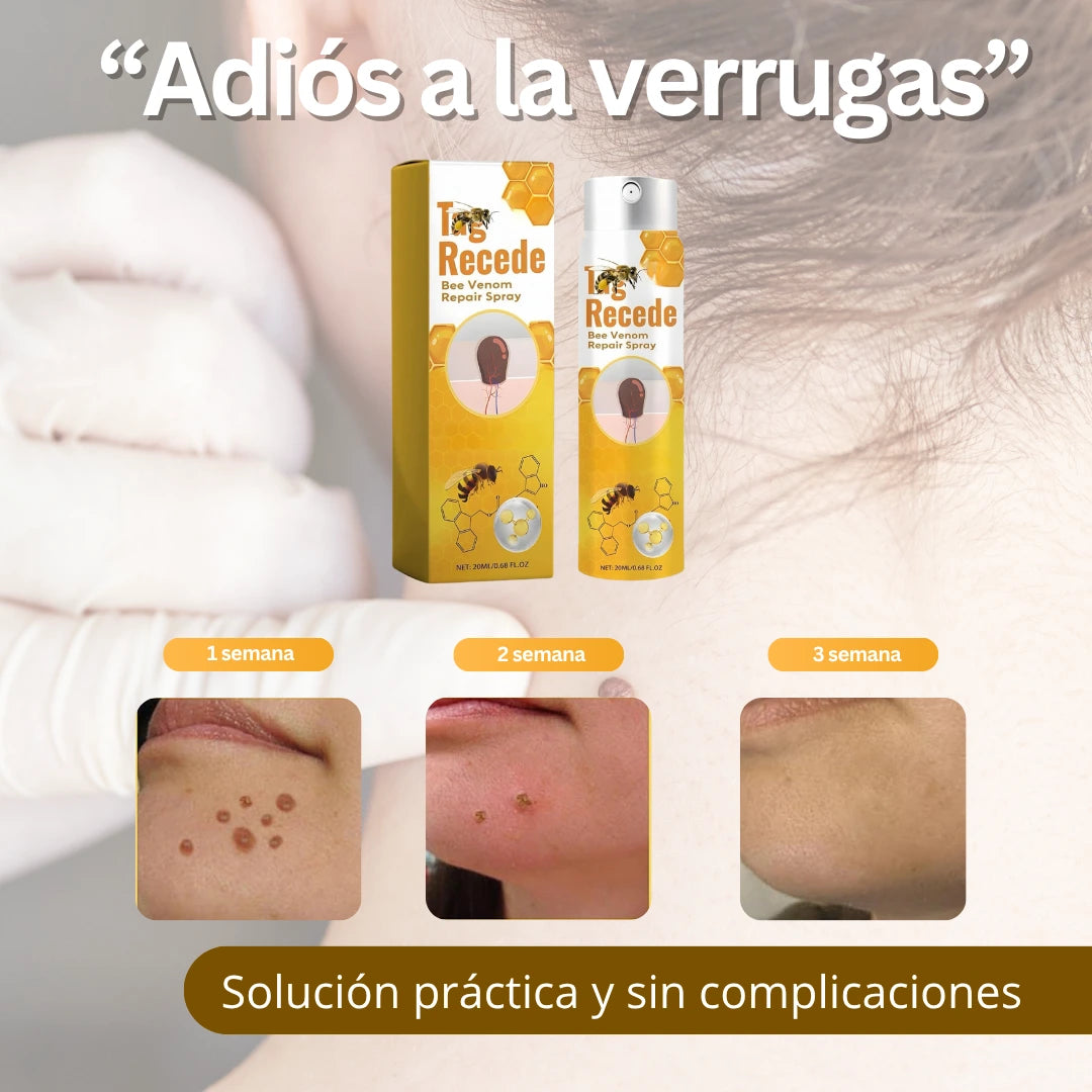 VERRUCLEAR