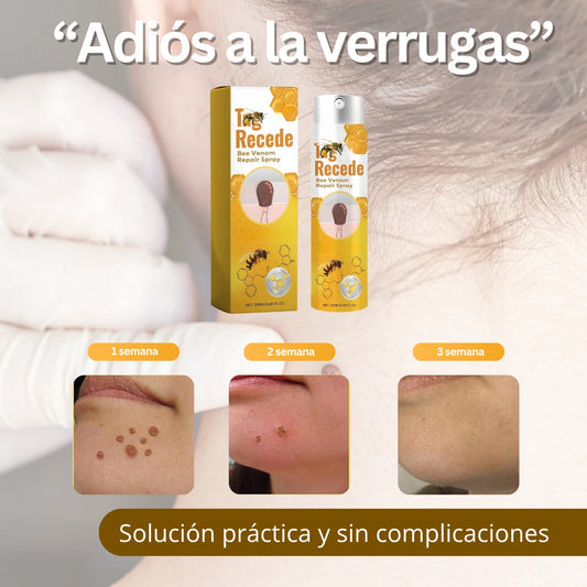 VERRUCLEAR