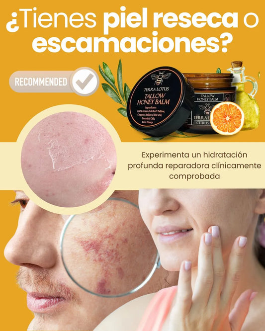 Restaura Tu Piel con el Poder de la Miel y el Sebo Natural